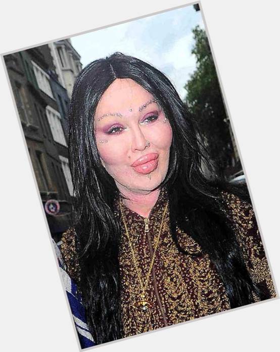 pete burns before and after 0
